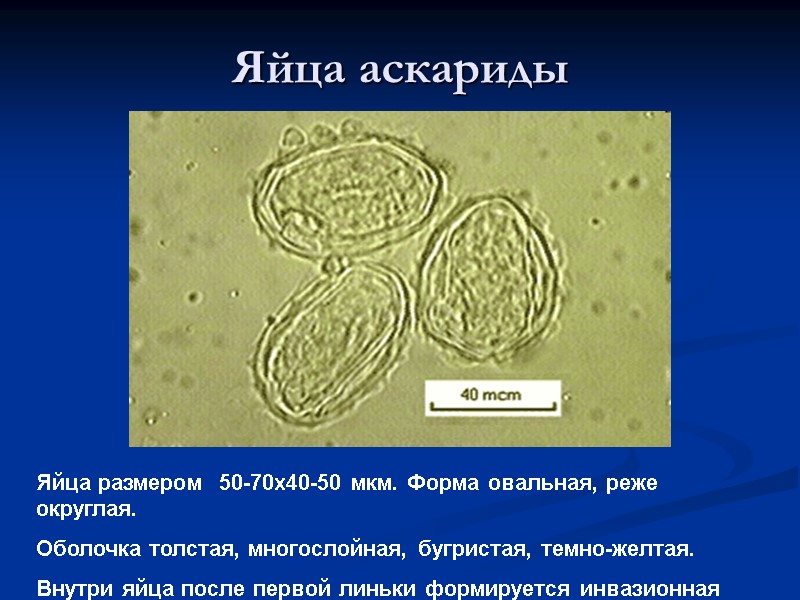 Яйца аскариды Яйца размером  50-70х40-50 мкм. Форма овальная, реже округлая. Оболочка толстая, многослойная,